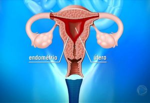 endometrio_utero